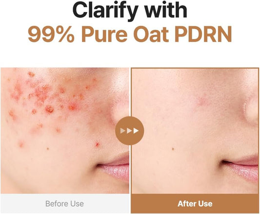 PURITO Oat PDRN Gentle Refining Toner 200ml - PURITO K-Beauty