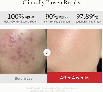 Medicube Red Succinic Acid Peeling Pads - Medicube K-Beauty