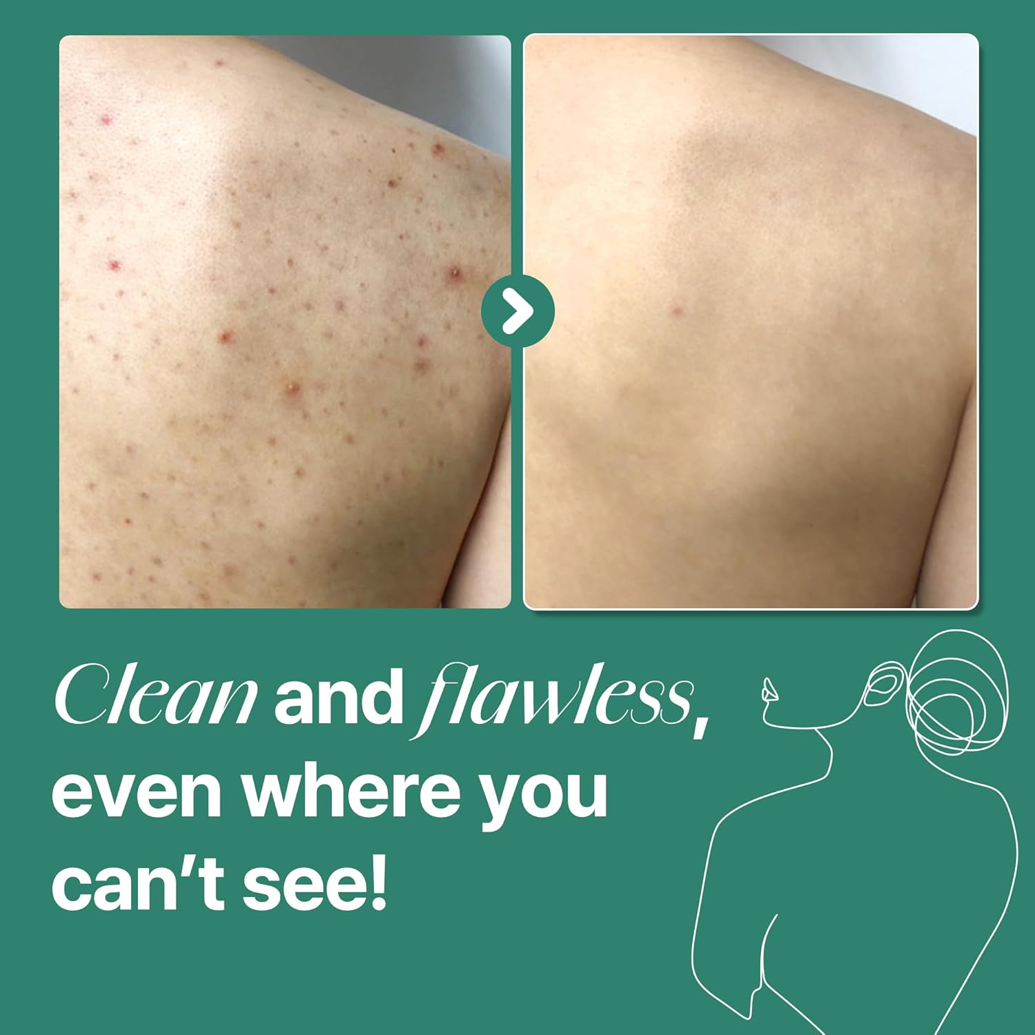 Some By Mi AHA BHA PHA Body Cleanser - Some By Mi K-Beauty