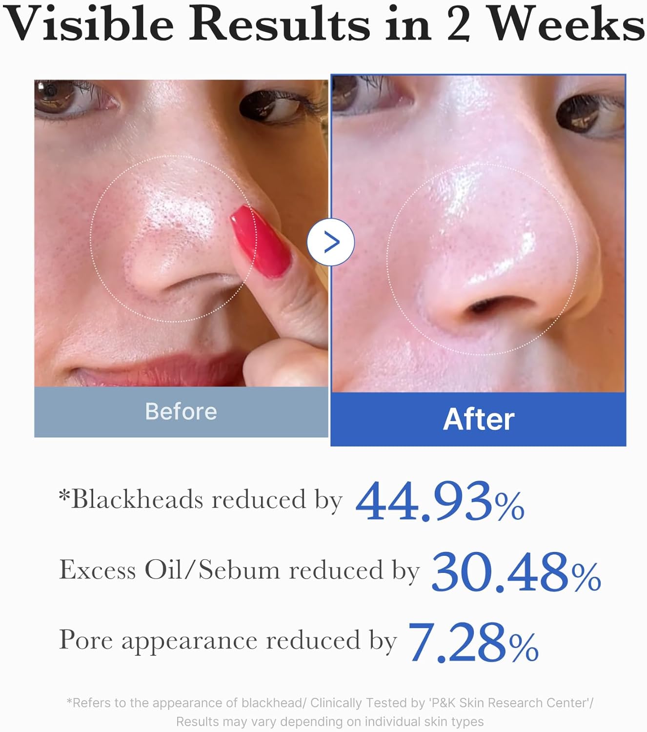 Medicube Zero Pore Pad 2.0 - Medicube K-Beauty