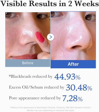Medicube Zero Pore Pad 2.0 - Medicube K-Beauty