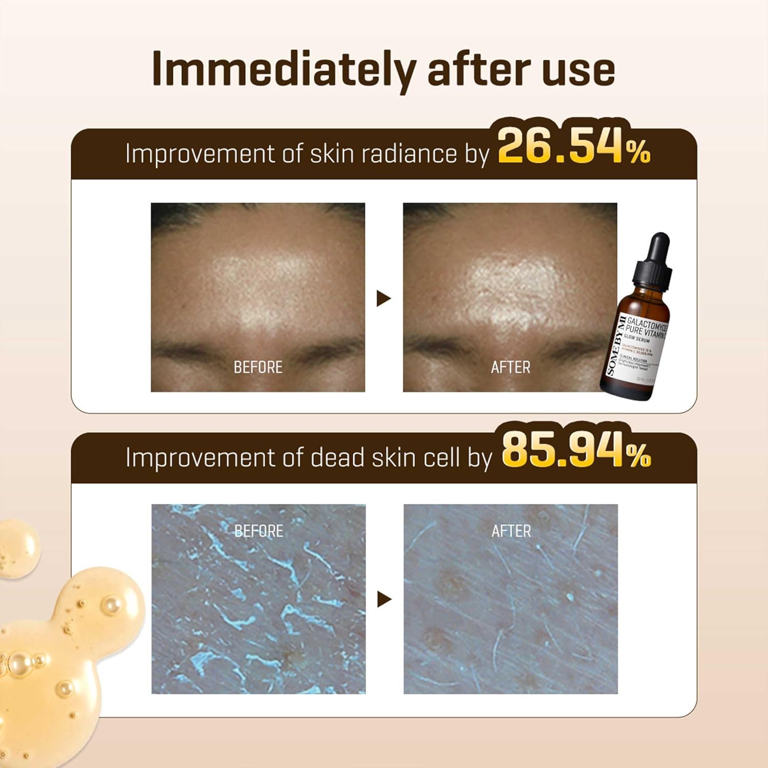 Some By Mi Galactomyces Vitamin C Serum - Some By Mi K-Beauty