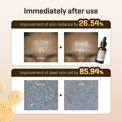 Some By Mi Galactomyces Vitamin C Serum - Some By Mi K-Beauty