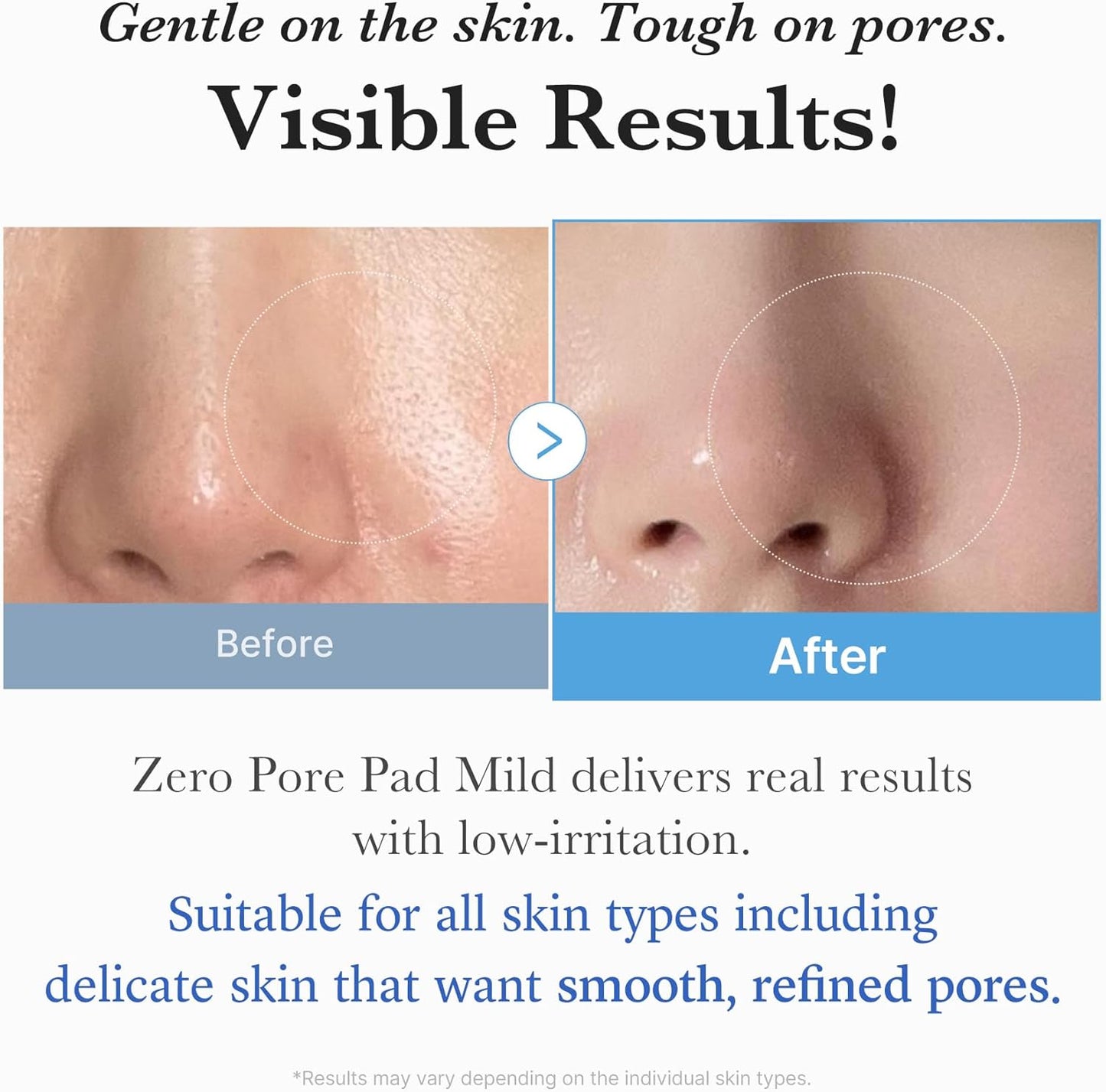 Medicube Zero Pore Pad Mild, Gentle PHA, Sensitive Skin 70 Pads - Medicube K-Beauty
