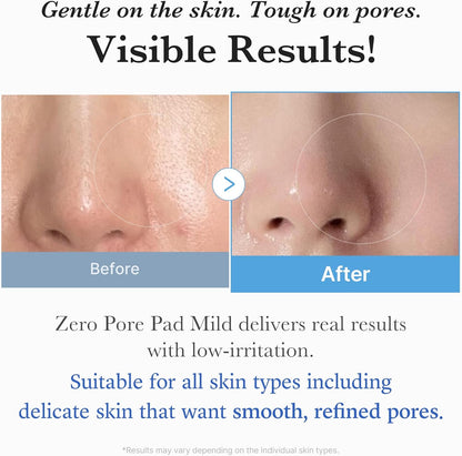 Medicube Zero Pore Pad Mild, Gentle PHA, Sensitive Skin 70 Pads - Medicube K-Beauty