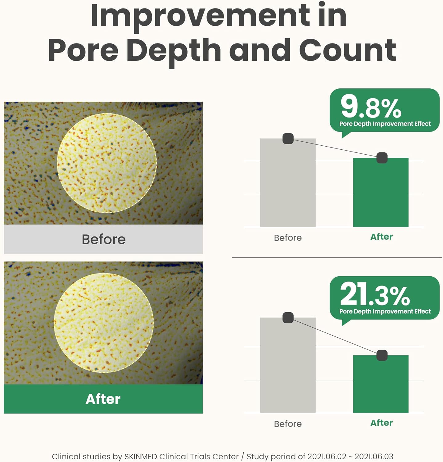 AXIS-Y Mugwort Pore Clarifying Mask - AXIS-Y K-Beauty