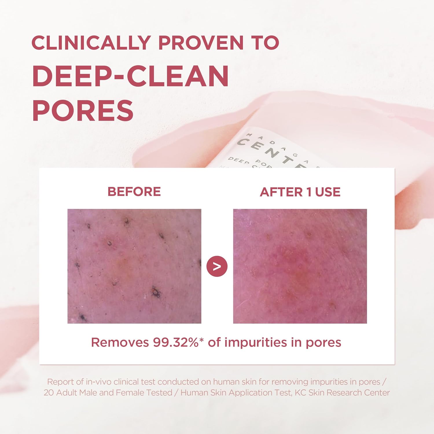 SKIN1004 Poremizing Deep Cleansing Foam - SKIN1004 K-Beauty