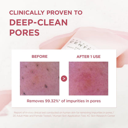 SKIN1004 Poremizing Deep Cleansing Foam - SKIN1004 K-Beauty