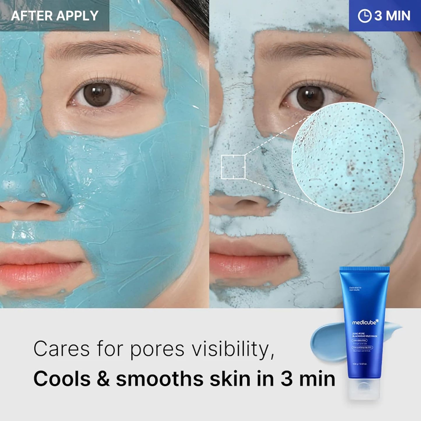 Medicube Zero Pore Blackhead Mud Mask, 100g - Medicube K-Beauty
