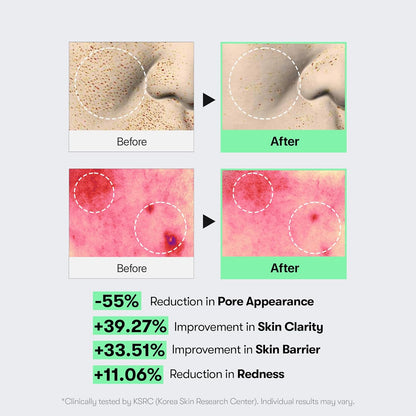 VT Cosmetics CICA Reedle Shot 100 - VT Cosmetics K-Beauty