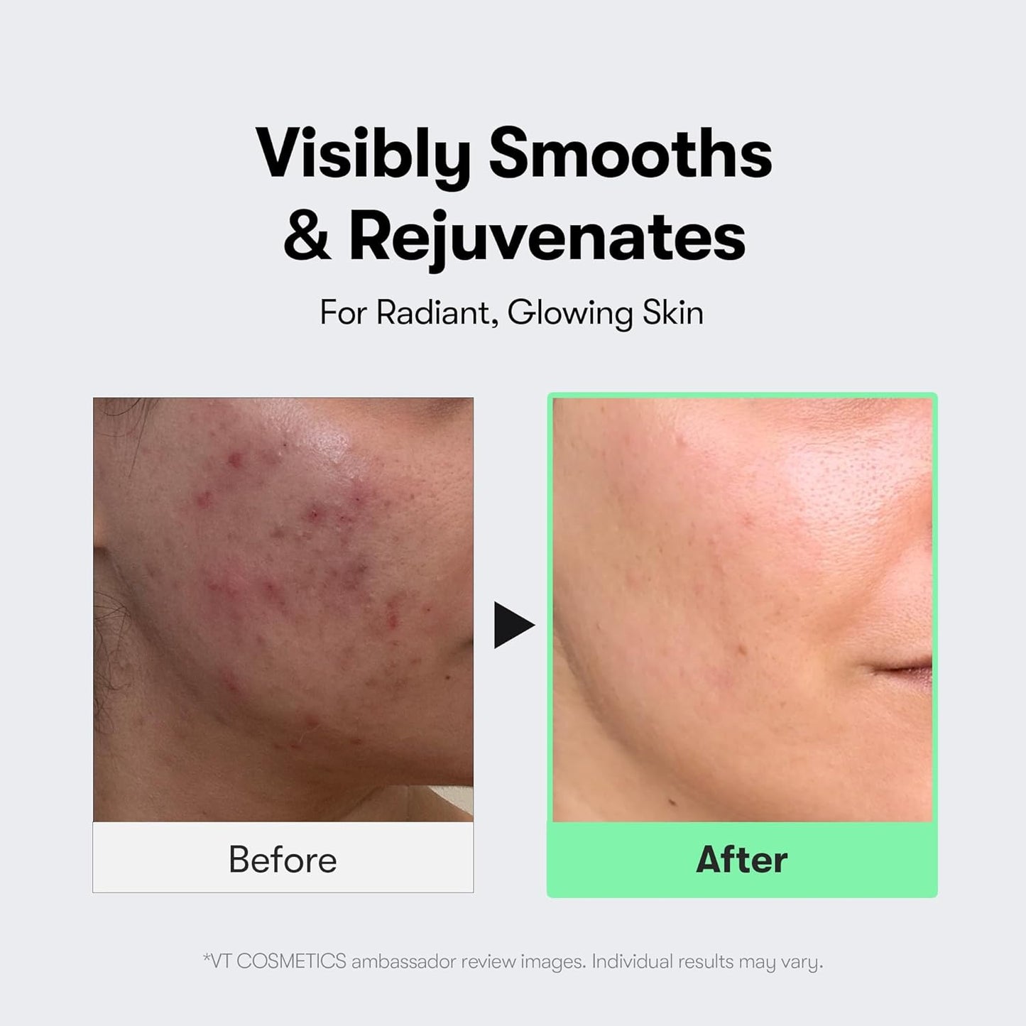VT Cosmetics CICA Reedle Shot 100 - VT Cosmetics K-Beauty