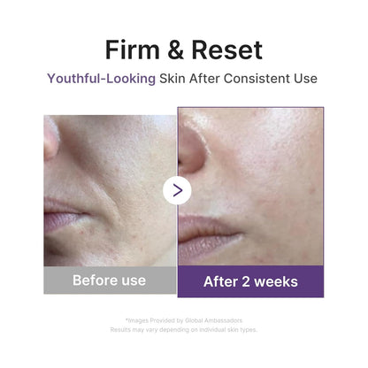 Medicube Retinol Boosting Serum - Medicube K-Beauty