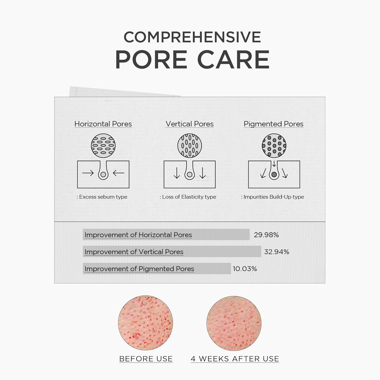 SKIN1004 Niacinamide 10% Boosting Ampoule 30ml - SKIN1004 K-Beauty