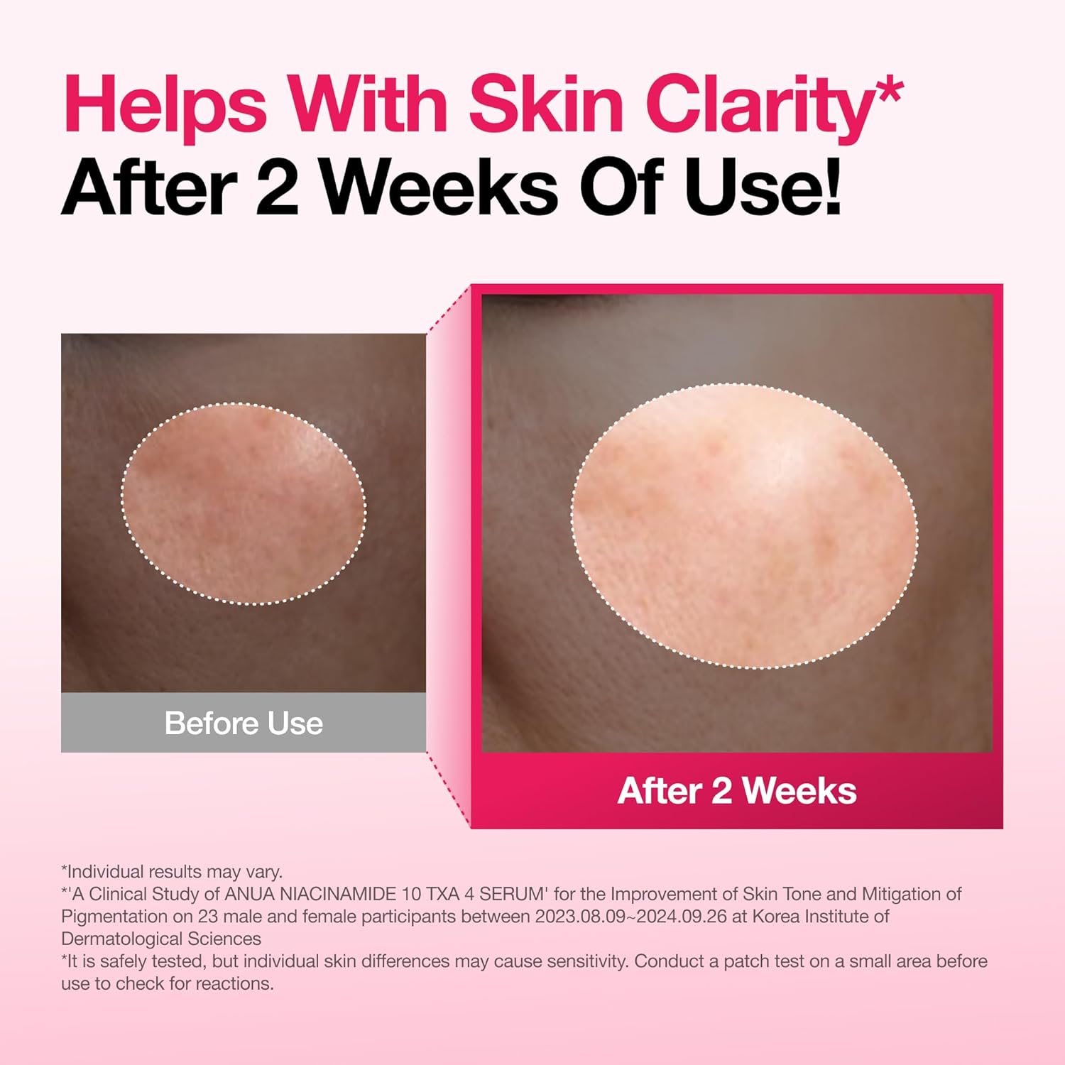 Anua Niacinamide 10 + TXA 4 Serum - Anua K-Beauty